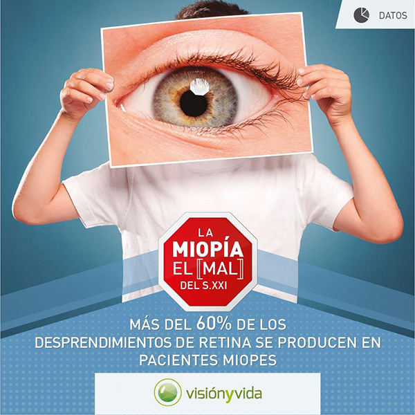 Miopía juvenil-Complicación de desprendimiento de retina