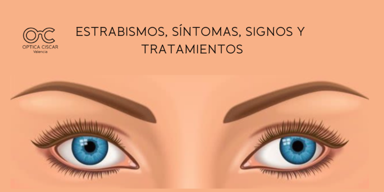 estrabismo - Síntomas, tratamientos en tu Óptica en Valencia